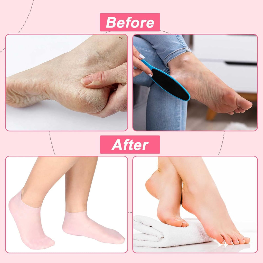 🔥Buy one get one free for the first 50 customers!🔥 - Moisturizing Foot Mask Exfoliating Silicone Socks Beach Protective Socks